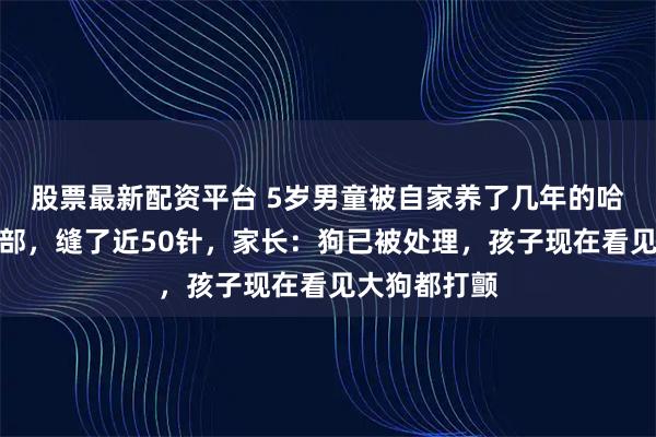 股票最新配资平台 5岁男童被自家养了几年的哈士奇咬伤面部，缝了近50针，家长：狗已被处理，孩子现在看见大狗都打颤